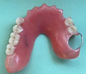 Photo of a partial denture made from acrylic